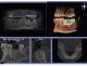 Co přináší 3D RTG zobrazení pro moderní stomatologii?