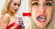 Dietní cola ničí zuby podobně jako pervitin, varuje studie Zuby v ohrožení