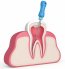 Endodoncie - čištění kanálků