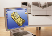 Zubní robot CEREC: celokeramické výplně, korunky a fasety na počkání