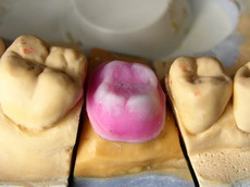 IV. Jak se dělá korunka - výrobní postup v zubní laboratoři